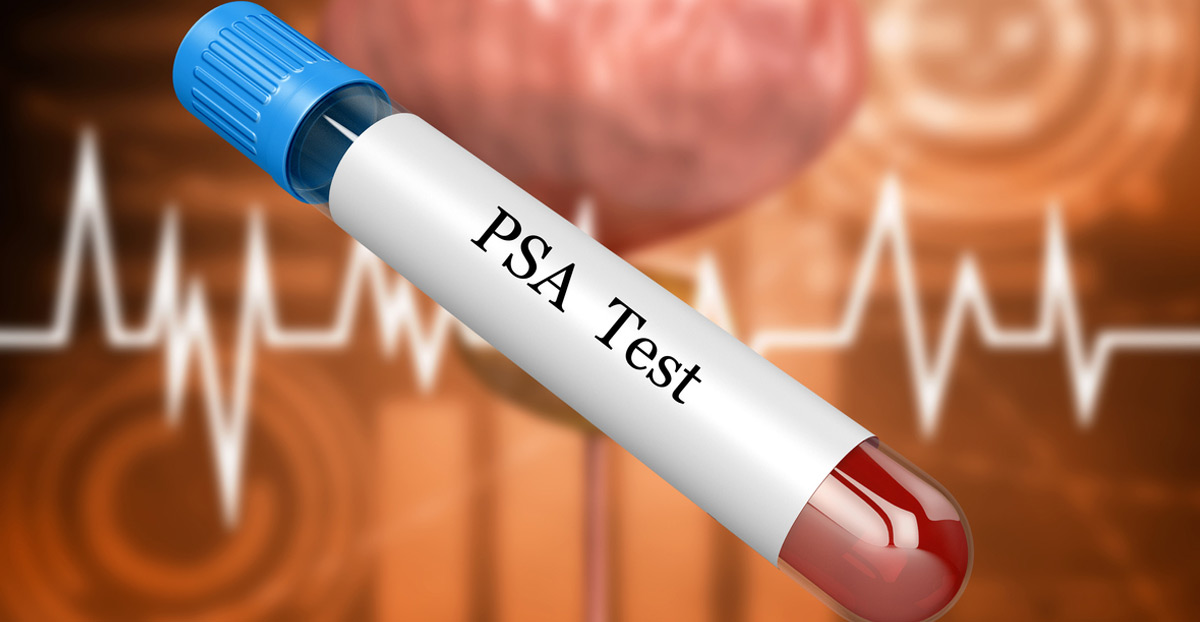 3D-rendering-of-a-blood-sample-for-a-PSA-test-Best-Urologist-in-Los-Angeles